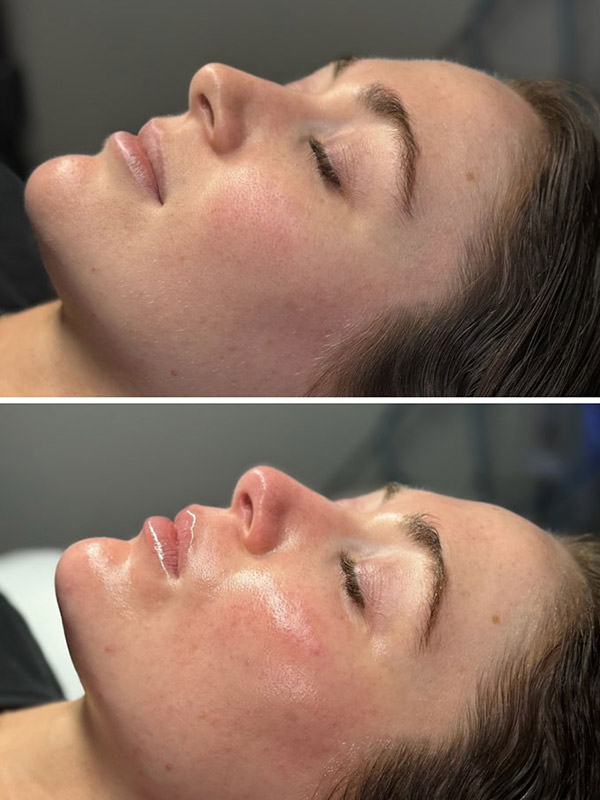 dermaplaning-by-Giana-DiPietro