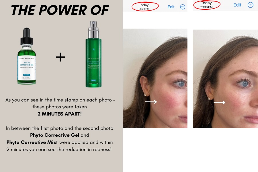 Before and after treatment image